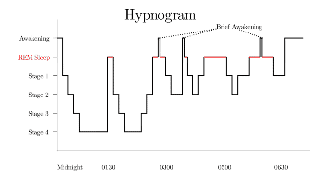 Sleep Cycle Hypnogram