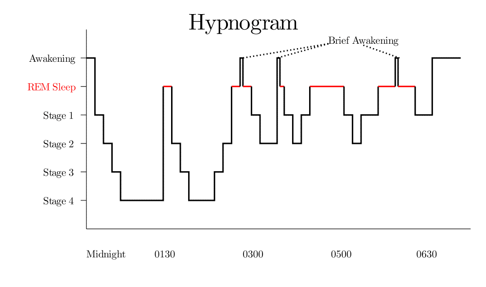 Sleep Cycle Hypnogram